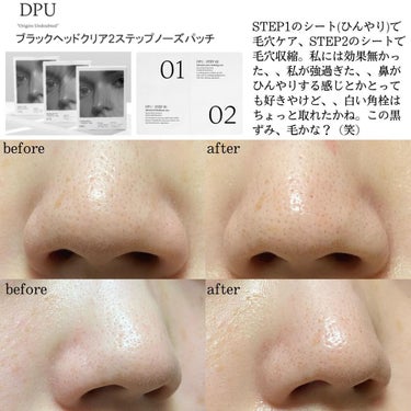 リアル アミノ ジェントル クレンザー/DPU/洗顔フォームを使ったクチコミ（2枚目）