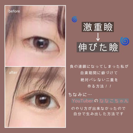 アイビューティー フィクサー WP/アストレア ヴィルゴ/二重まぶた用アイテムを使ったクチコミ(1枚目)