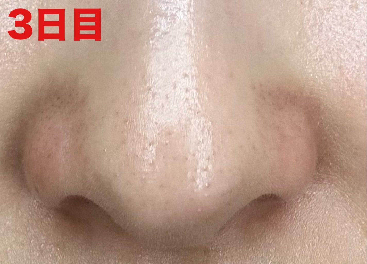 3番 緑茶炭毛穴パッククレンジングバーム/numbuzin/クレンジングバームを使ったクチコミ(5枚目)