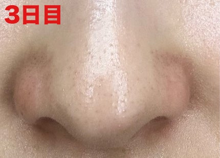 3番 緑茶炭毛穴パッククレンジングバーム/numbuzin/クレンジングバームを使ったクチコミ(5枚目)