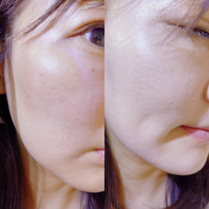 ロングラスティングチップコンシーラー/LUNA/リキッドコンシーラーを使ったクチコミ(3枚目)