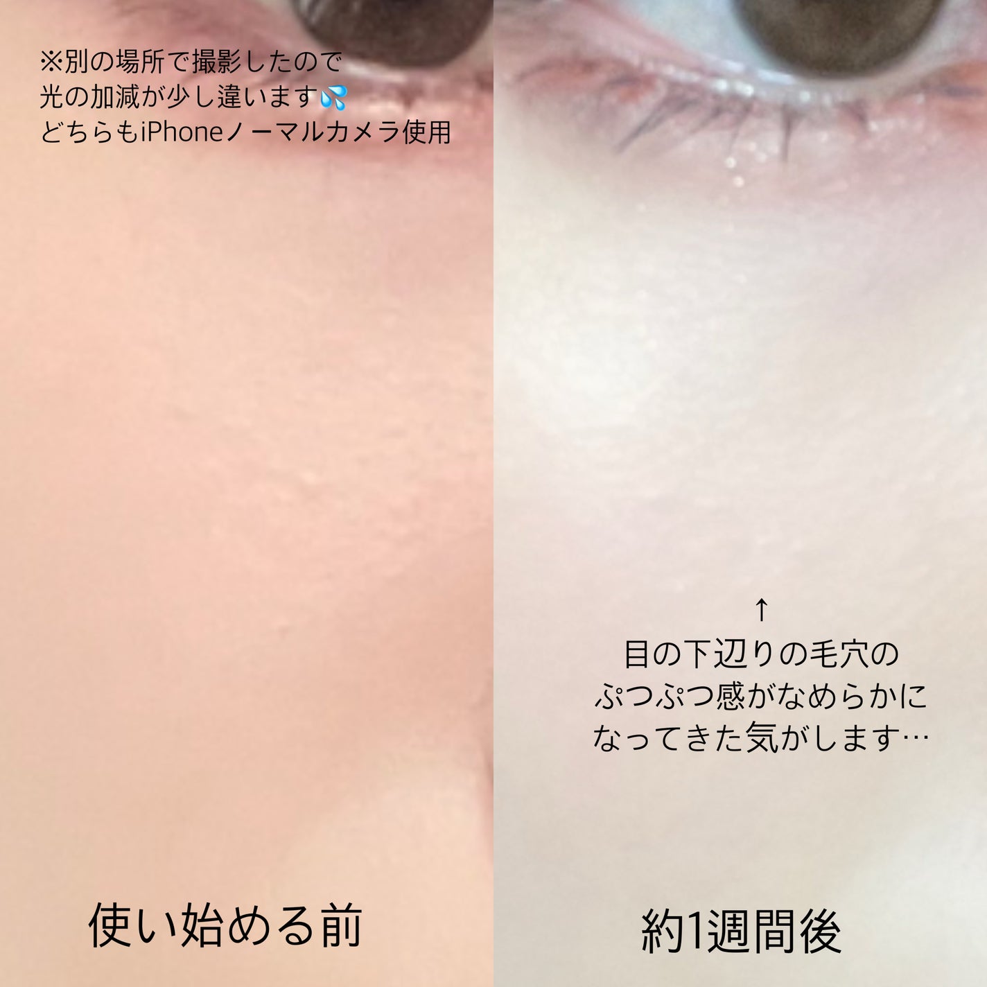 ゼロ1DAYエクソソームショット2000/MEDICUBE/美容液を使ったクチコミ(3枚目)