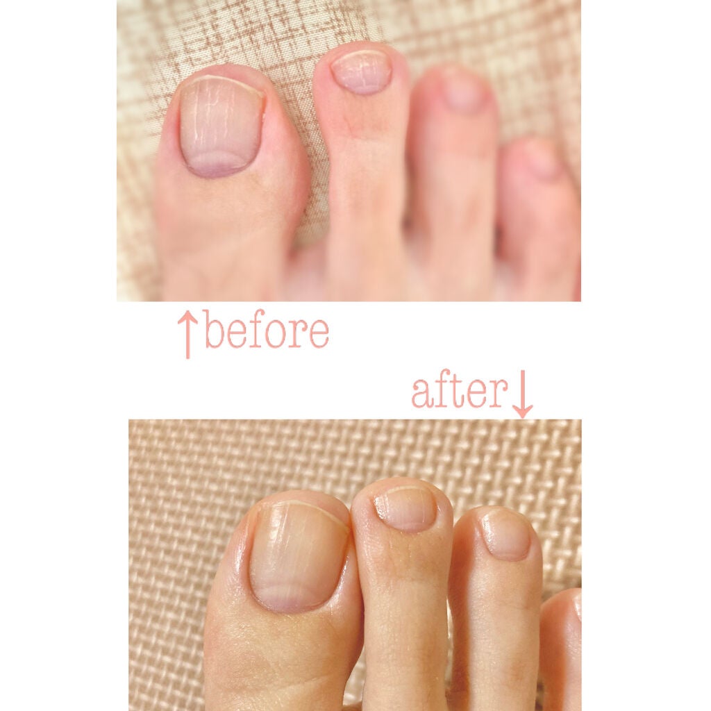 ネイルケアオイル/無印良品/ネイルオイル・トリートメントを使ったクチコミ(5枚目)
