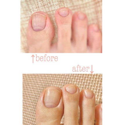 ネイルケアオイル/無印良品/ネイルオイル・トリートメントを使ったクチコミ(5枚目)