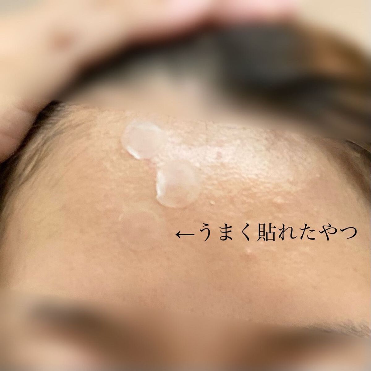 プロCICA クリアスポットパッチ/VT/その他スキンケアを使ったクチコミ(3枚目)