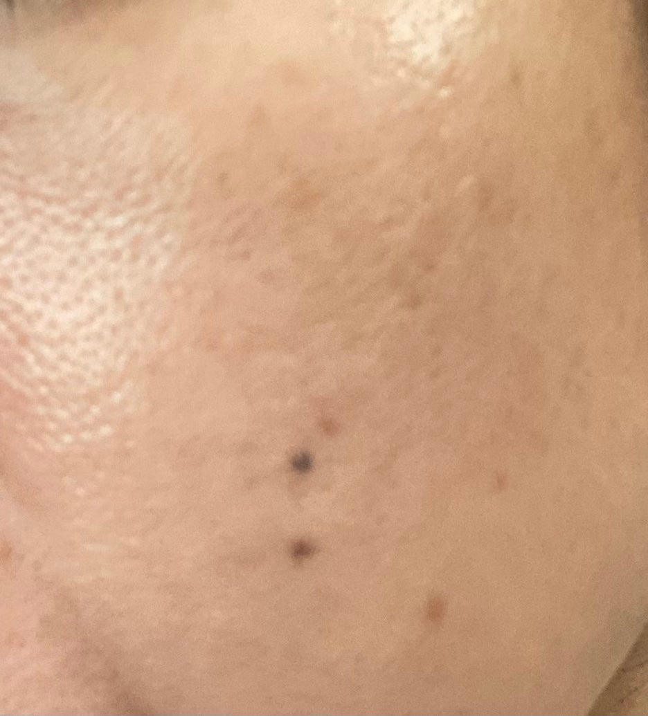 エッセンス スキングロウ ファンデーション/SHISEIDO/リキッドファンデーションを使ったクチコミ(2枚目)