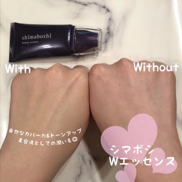 Wエッセンス/shimaboshi/美容液を使ったクチコミ（3枚目）