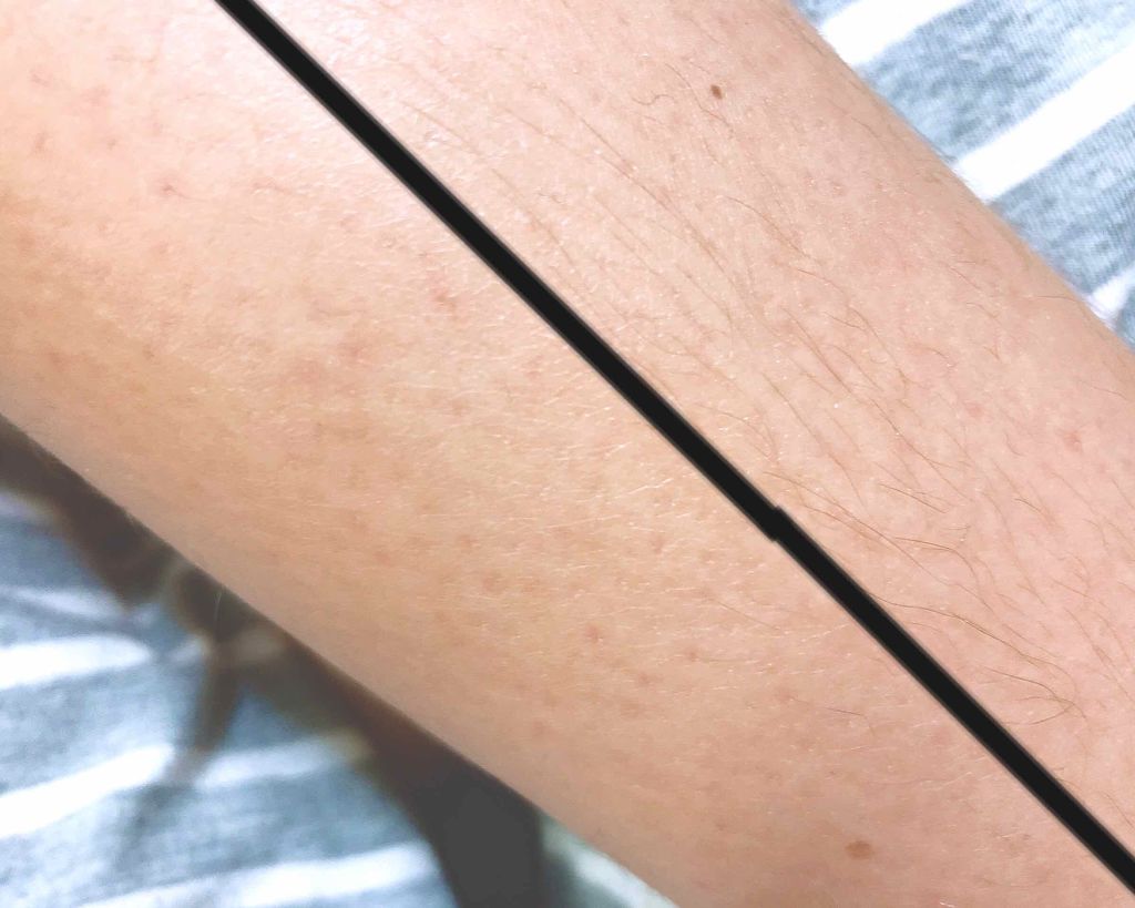 脱毛 ワックスシート/DAISO/除毛クリームを使ったクチコミ（3枚目）