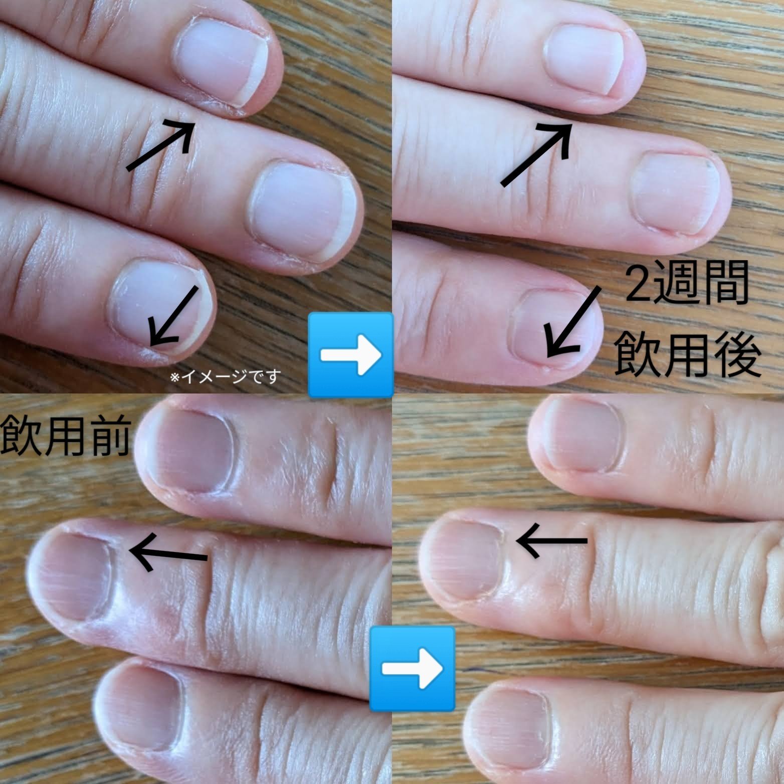 モミカプレミアム/momika/美容サプリメントを使ったクチコミ（1枚目）