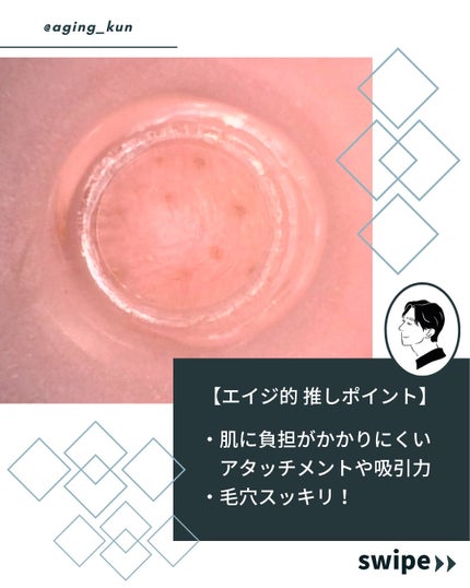 アレティ ポアスコープ/Areti./美顔器・マッサージを使ったクチコミ(3枚目)