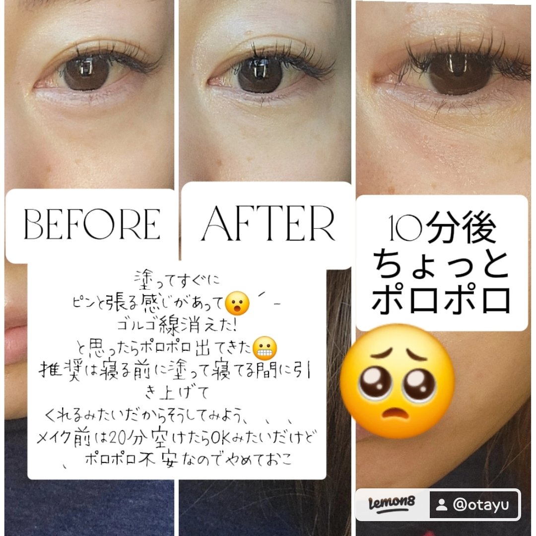 Cemenrete Calcium Intense Cream/Dr.Melaxin/フェイスクリームを使ったクチコミ（3枚目）