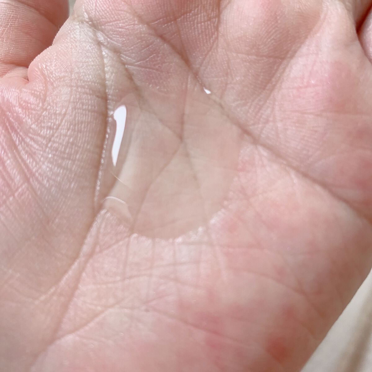 頭皮アンプル/GROWUS/頭皮ローションを使ったクチコミ（3枚目）