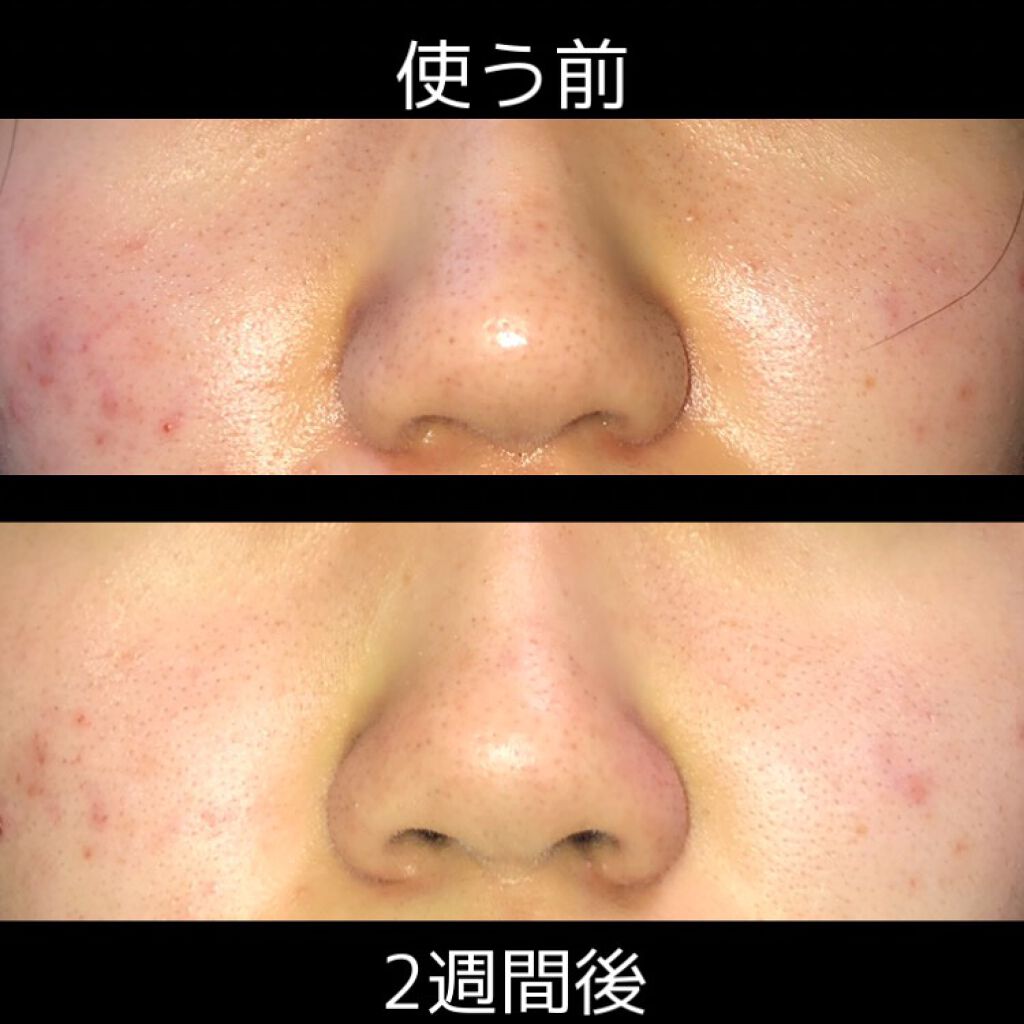 デュオ ザ クレンジングバーム クリア/DUO/クレンジングバームを使ったクチコミ（2枚目）