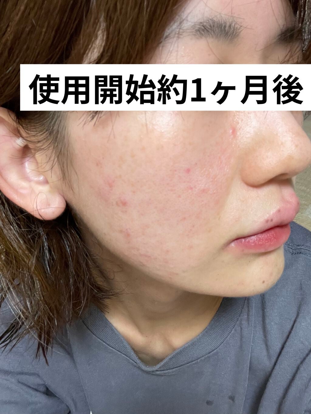 モイスチャーバランスローション/PHOEBE BEAUTY UP/化粧水を使ったクチコミ(3枚目)