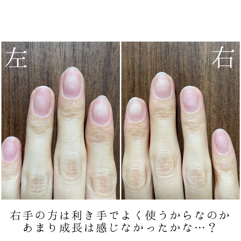 Gel Nail system 18/ネイル工房/ジェルネイルを使ったクチコミ（3枚目）