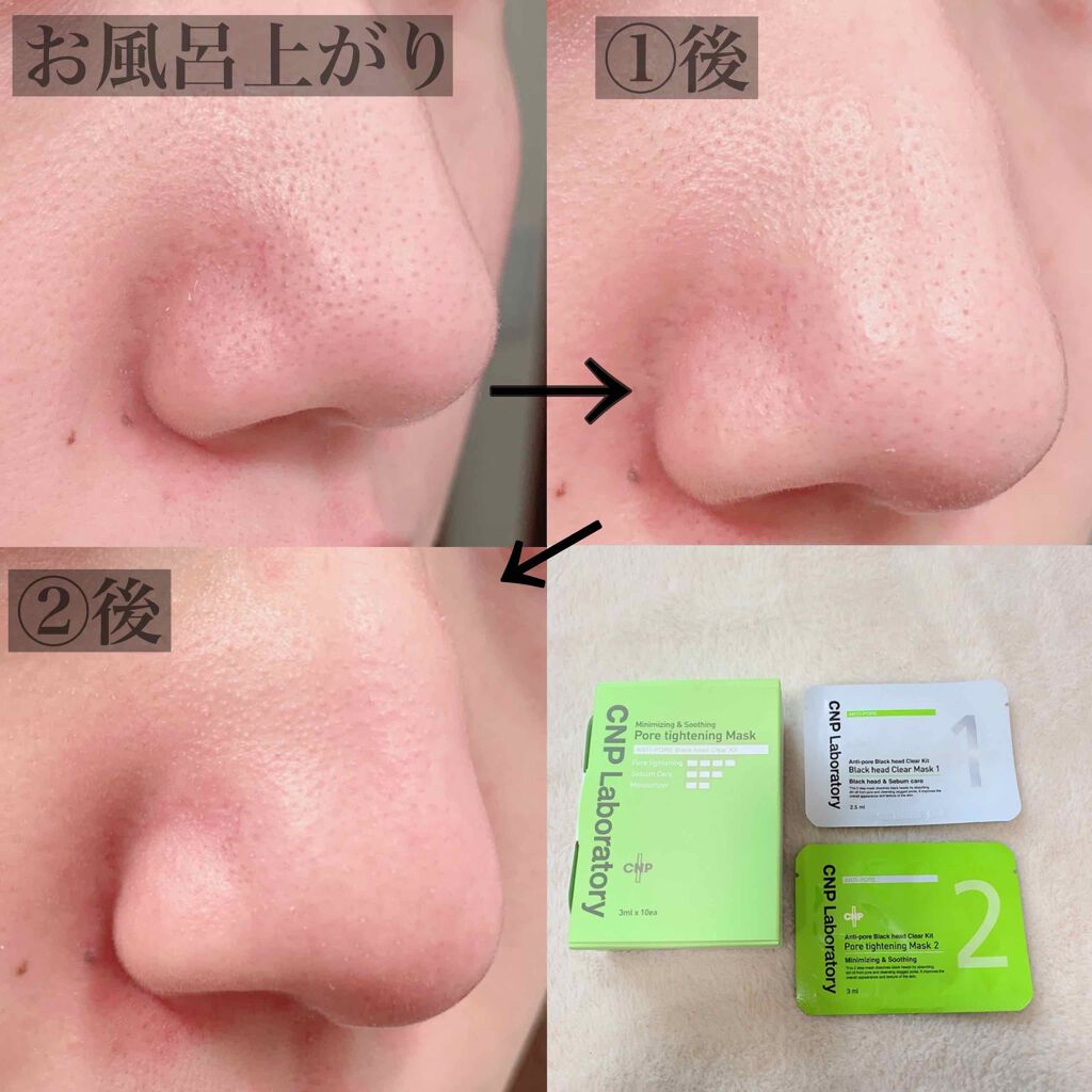 アンチポアブラックヘッドパーフェクトクリアキット/CNP Laboratory/シートマスク・パックを使ったクチコミ(2枚目)
