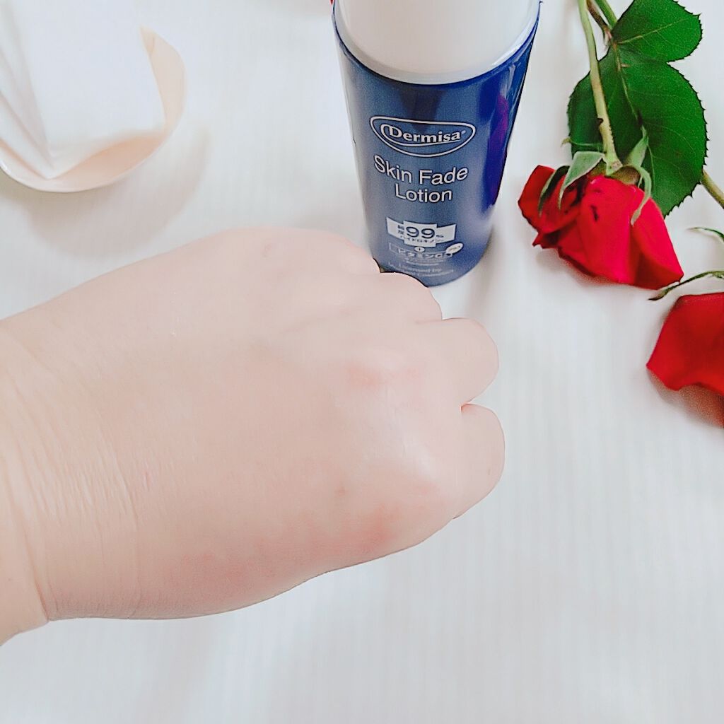 スキンフェイドローションV/デルミサ/化粧水を使ったクチコミ(3枚目)