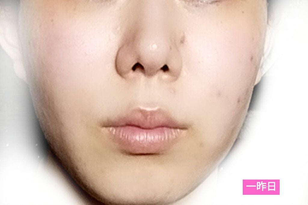 ザ・コラーゲン<ドリンク>V/ザ・コラーゲン/美容ドリンクを使ったクチコミ(2枚目)