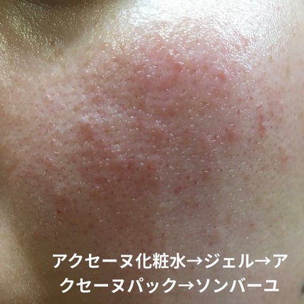 モイストバランス ジェル/ACSEINE/美容液を使ったクチコミ(1枚目)