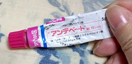 ベタメゾン軟膏/ジャパンメディック/その他スキンケアを使ったクチコミ(2枚目)