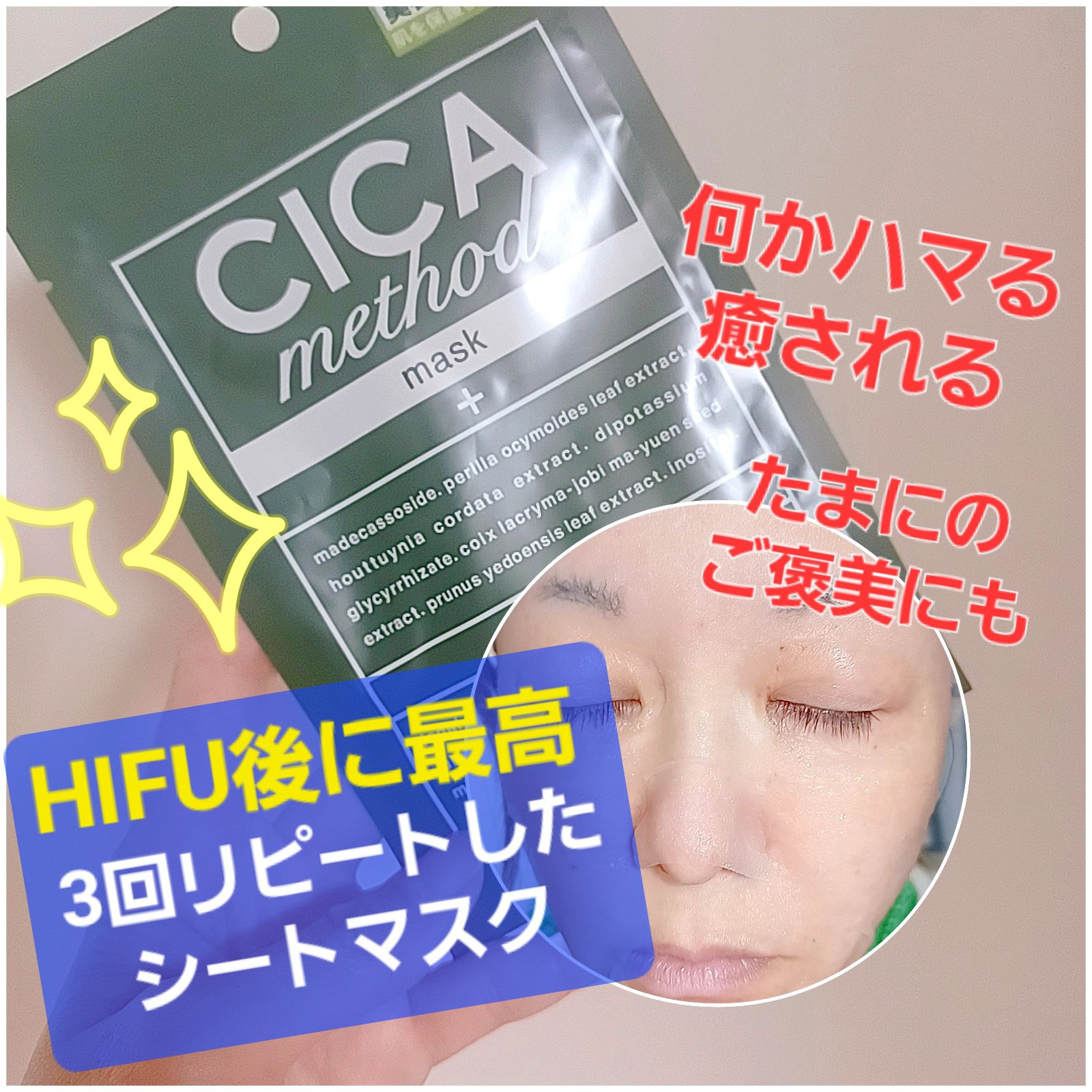 シカ メソッド マスク/コジット/シートマスク・パックを使ったクチコミ（1枚目）
