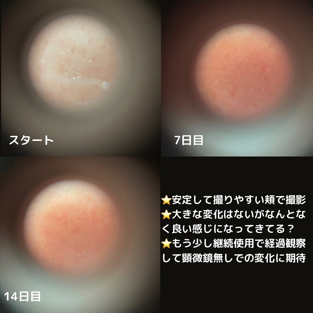 シカレチA エッセンス0.1/VT/美容液を使ったクチコミ(4枚目)