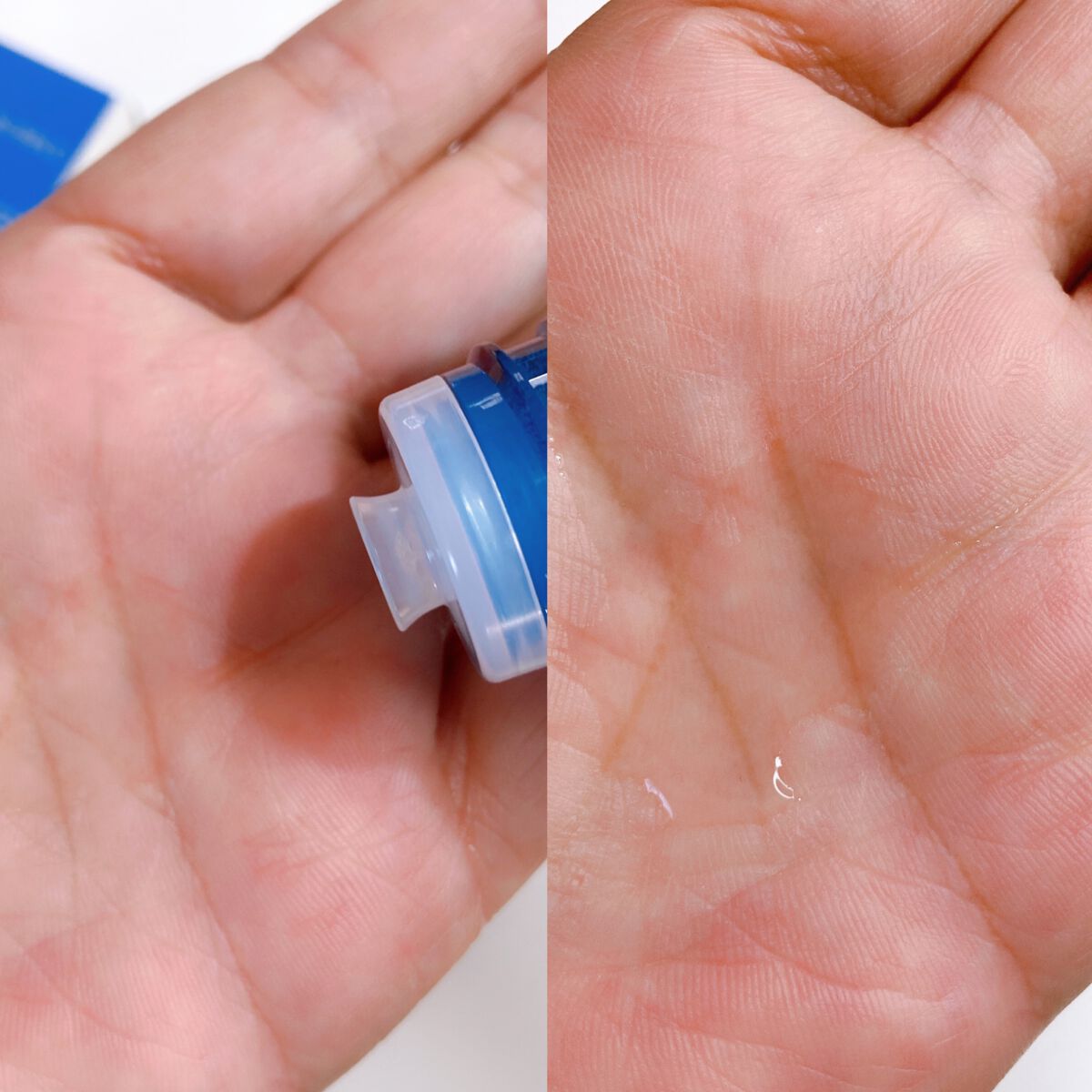 薬用マイクロバブルローション/Macchia Label/化粧水を使ったクチコミ(4枚目)