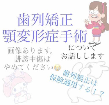 今回は歯列矯正と顎変形症の手術について
お話しさせていただきたいと思います🙏🏻
長くなりますが、これからやりたいと考えてる人など参考になればいいなと思いお話しさせていただきます😳💙

私は歯列矯正今年で