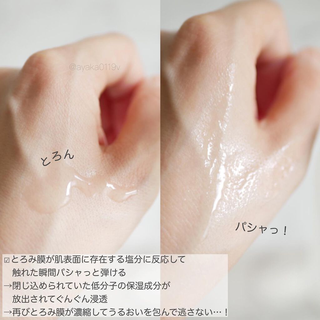 オルビスユー ローション/オルビス/化粧水を使ったクチコミ(3枚目)