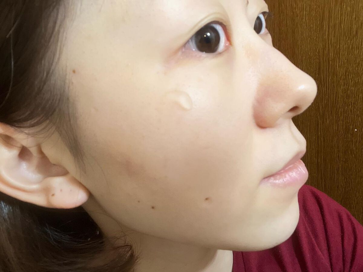 ピールショット/北の快適工房/ピーリングを使ったクチコミ（3枚目）