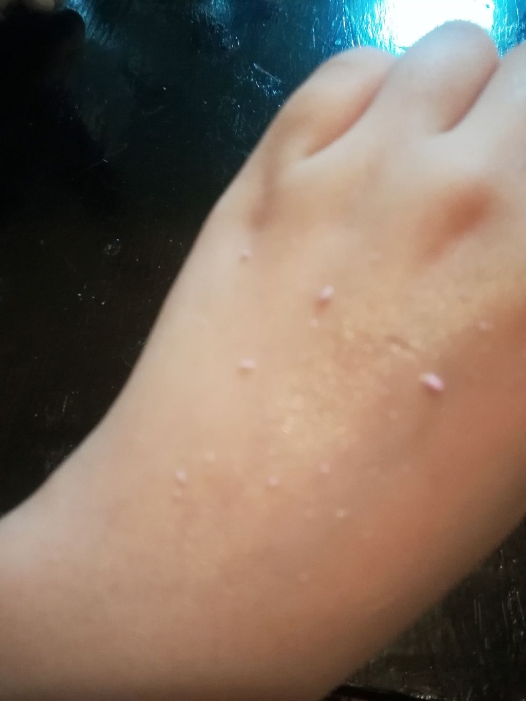 ココロ氏 on LIPS 「⚠️2枚目角質の写真出ます⚠️Lipsでもたびたび話題になって..」(2枚目)