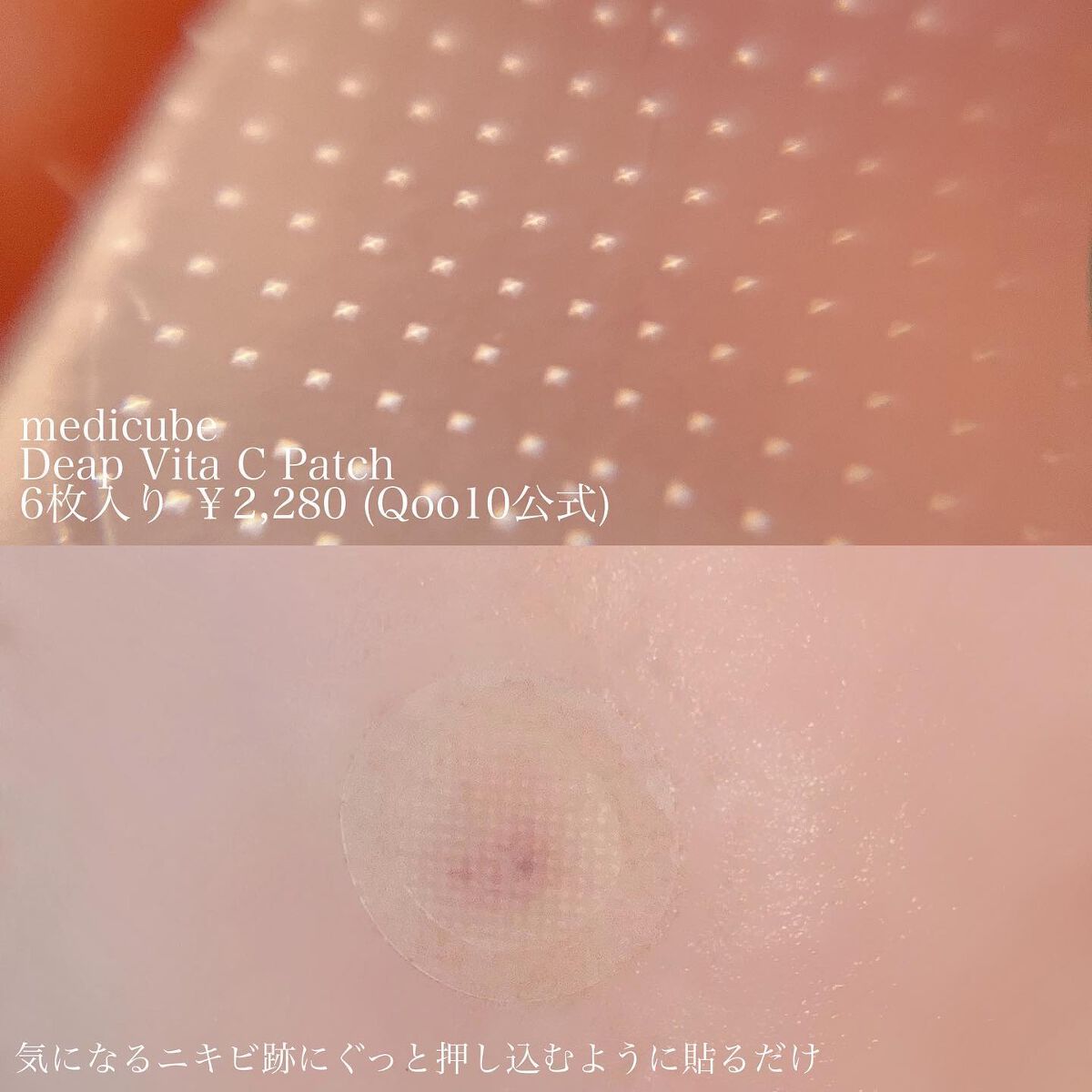ディープビタCパッチ/MEDICUBE/その他スキンケアを使ったクチコミ（2枚目）