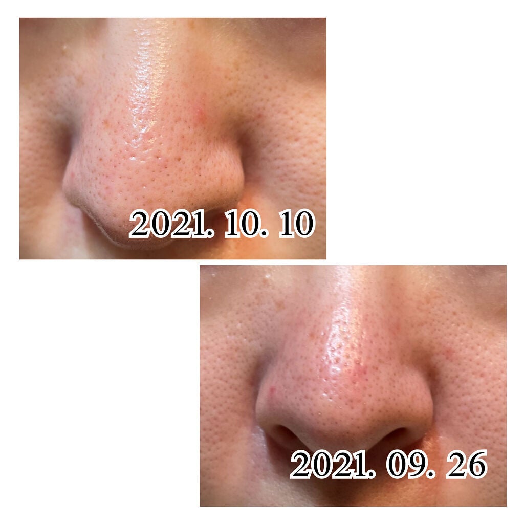 オバジC 酵素洗顔パウダー/オバジ/洗顔パウダーを使ったクチコミ(3枚目)