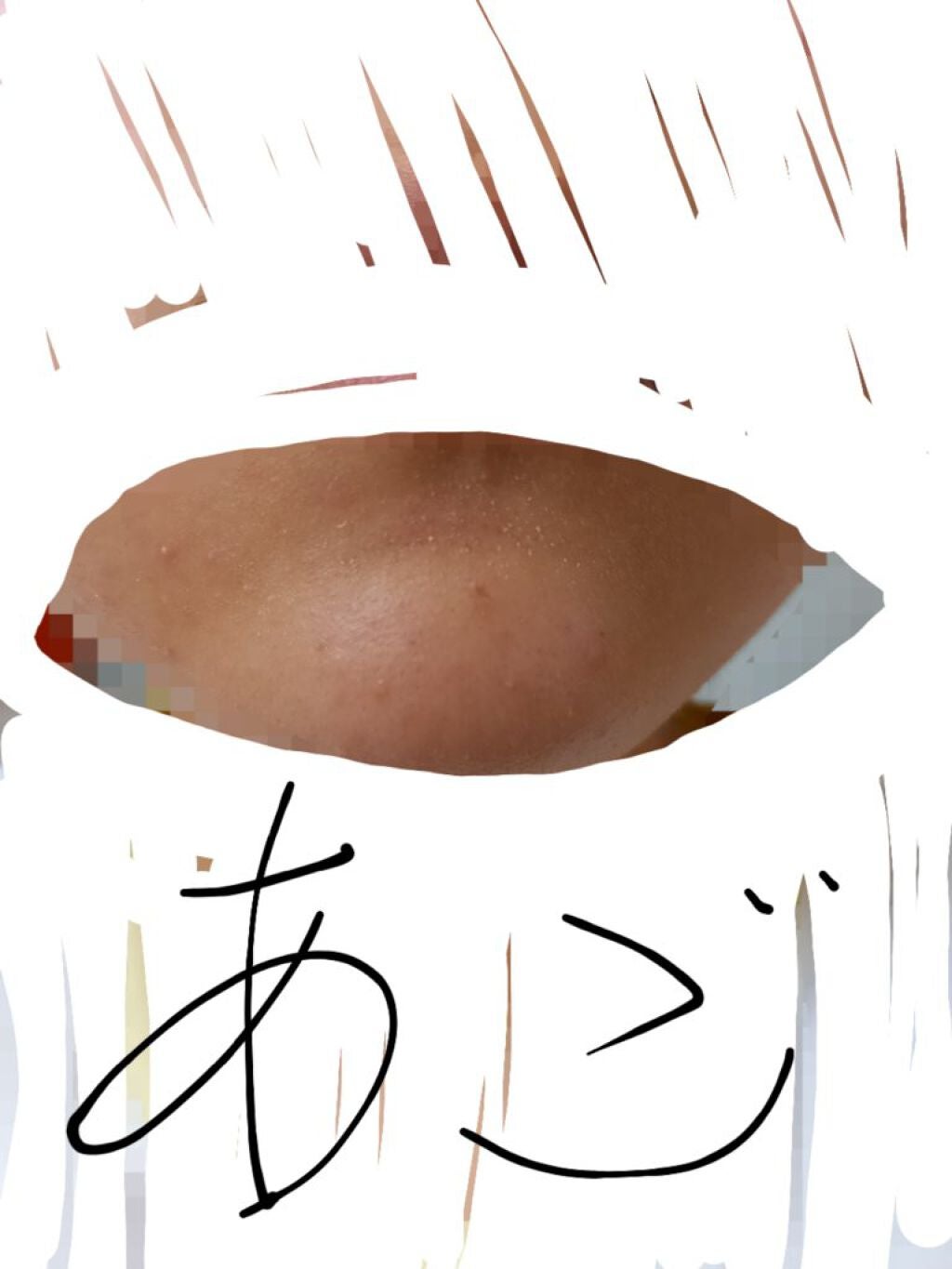 ペアアクネクリーンローション/ペア/化粧水を使ったクチコミ(5枚目)