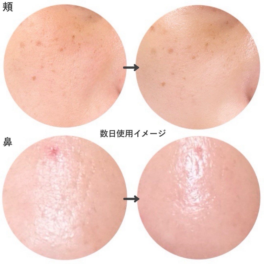 バイオヒールボ プロバイオダーム 3Dリフティングクリーム/BIOHEAL BOH/フェイスクリームを使ったクチコミ(8枚目)