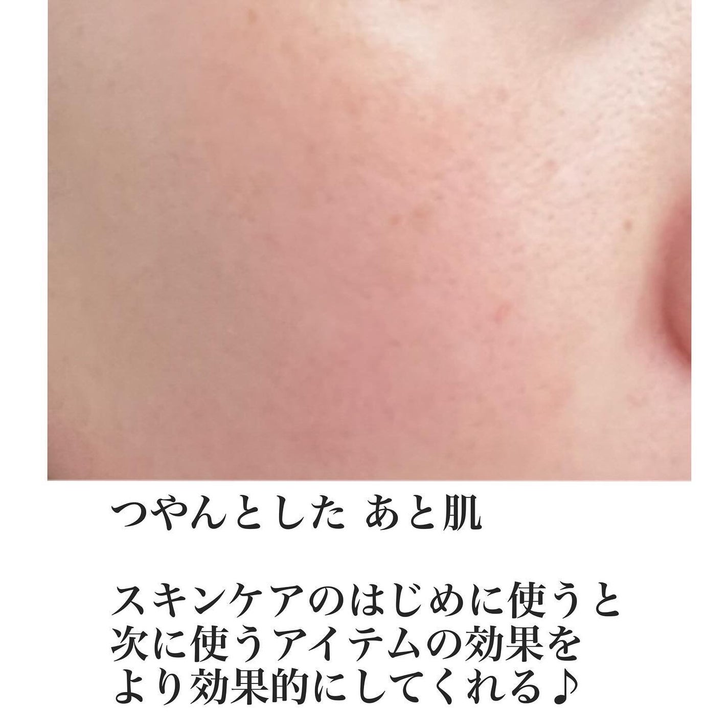 RXザ・6ペプチドスキンブースターセラム/COSRX/ブースター・導入液を使ったクチコミ(4枚目)