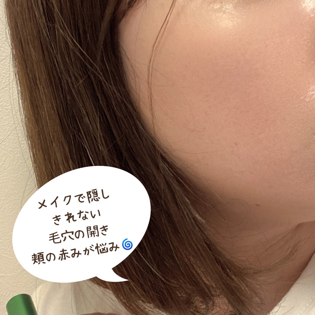 mapooh0131 on LIPS 「自宅で美容クリニック級のスキンケア!?ダーマセプトRXAZAセ..」(5枚目)