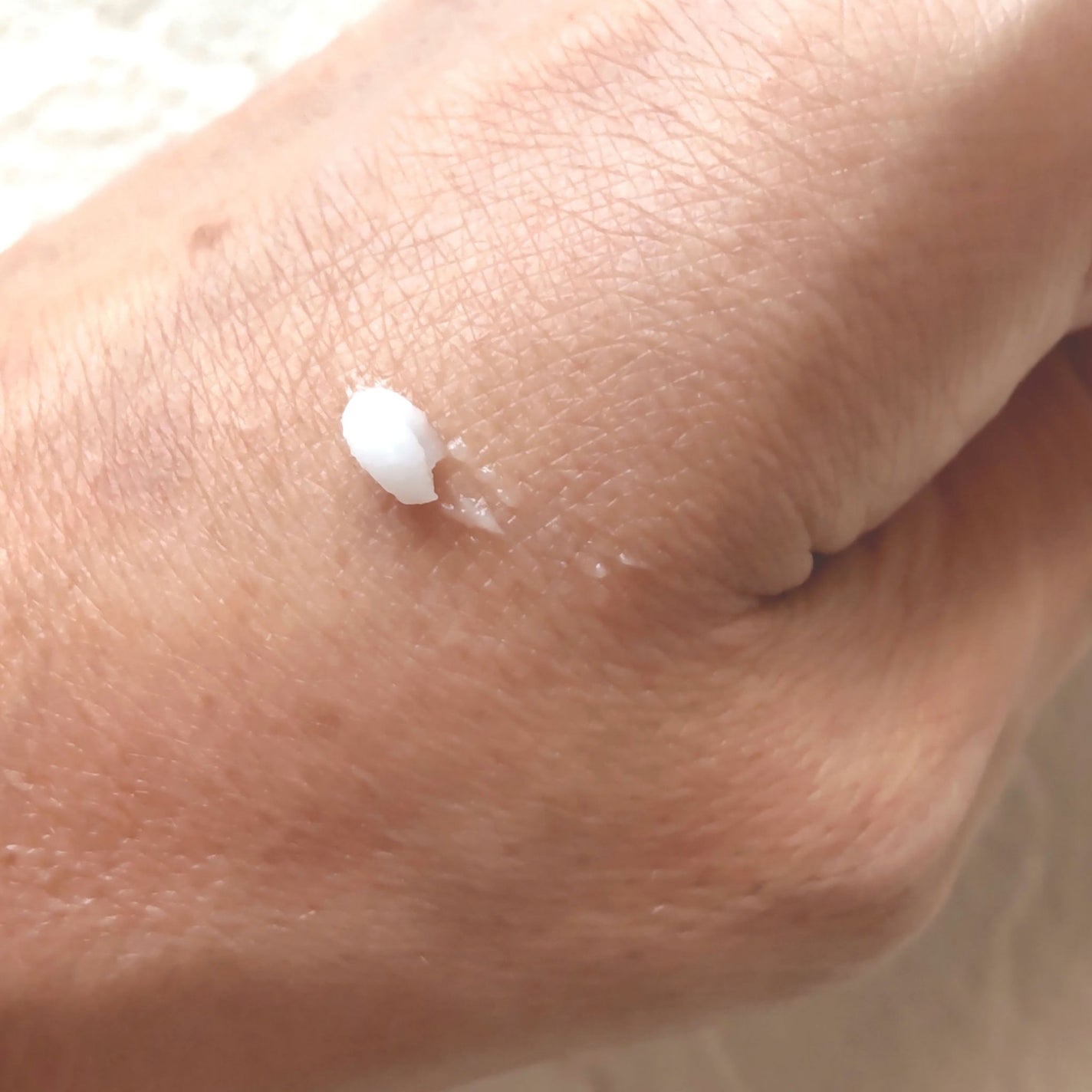 リンクルショット メディカル セラム N/リンクルショット/アイケア・アイクリームを使ったクチコミ(2枚目)