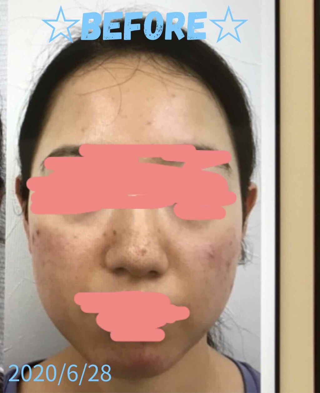 エクストラマイルドスキンローションI/ニュースキン/化粧水を使ったクチコミ(2枚目)