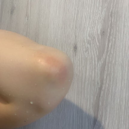 生ハーブボディピーリングスプレー /ナチュラルラボラトリーズ/ピーリングを使ったクチコミ(4枚目)