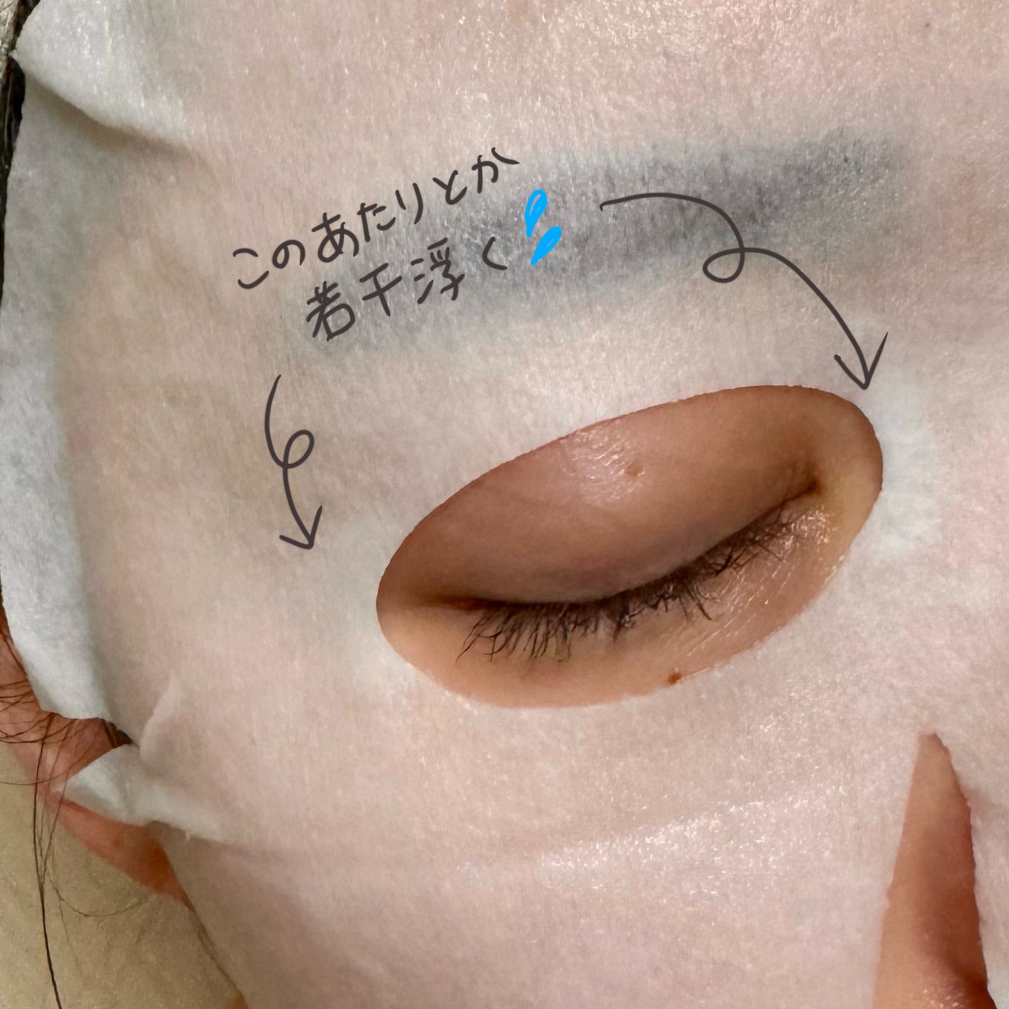 ダーマレーザースペクター VCMAX マスク/クオリティファースト/シートマスク・パックを使ったクチコミ(3枚目)