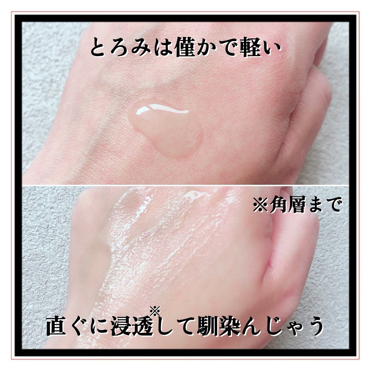 トラブルリペア リキッド/アルージェ/美容液を使ったクチコミ(5枚目)