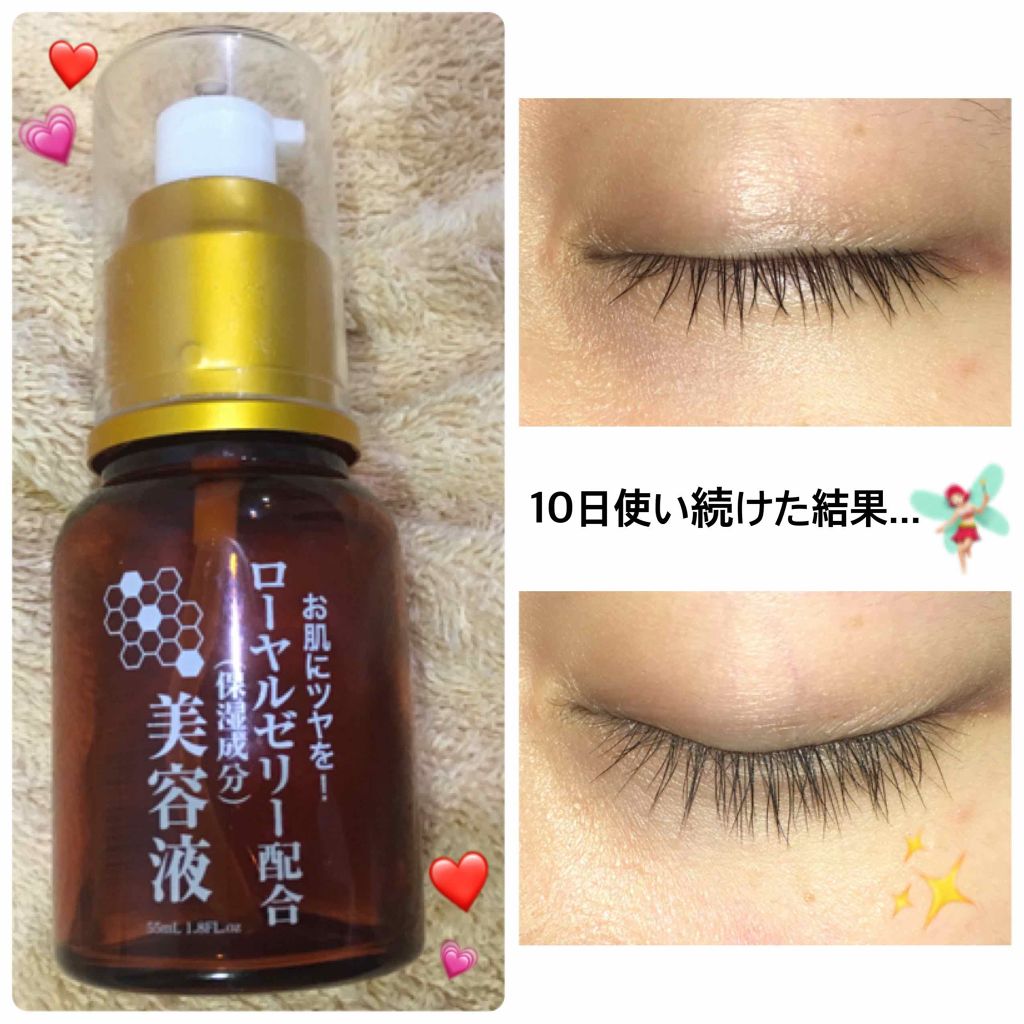 ローヤルゼリー配合 栄養ローション/DAISO/美容液を使ったクチコミ(1枚目)