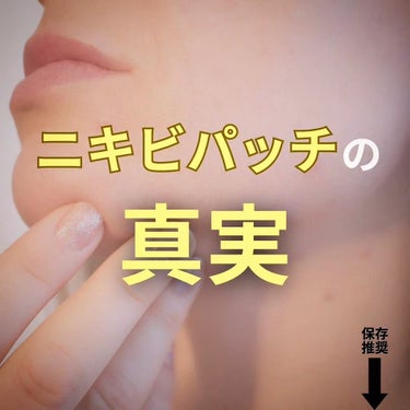 あき┃自分を好きになる垢抜け術 on LIPS 「＼保存推奨！　ニキビパッチはした方がいい？／先に結論ですあくま..」（1枚目）