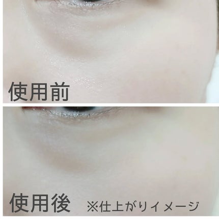 アイクリーム/someblossom/アイケア・アイクリームを使ったクチコミ(5枚目)