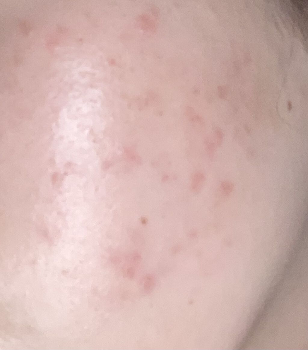 潤浸保湿 化粧水 III とてもしっとり/キュレル/化粧水を使ったクチコミ（1枚目）