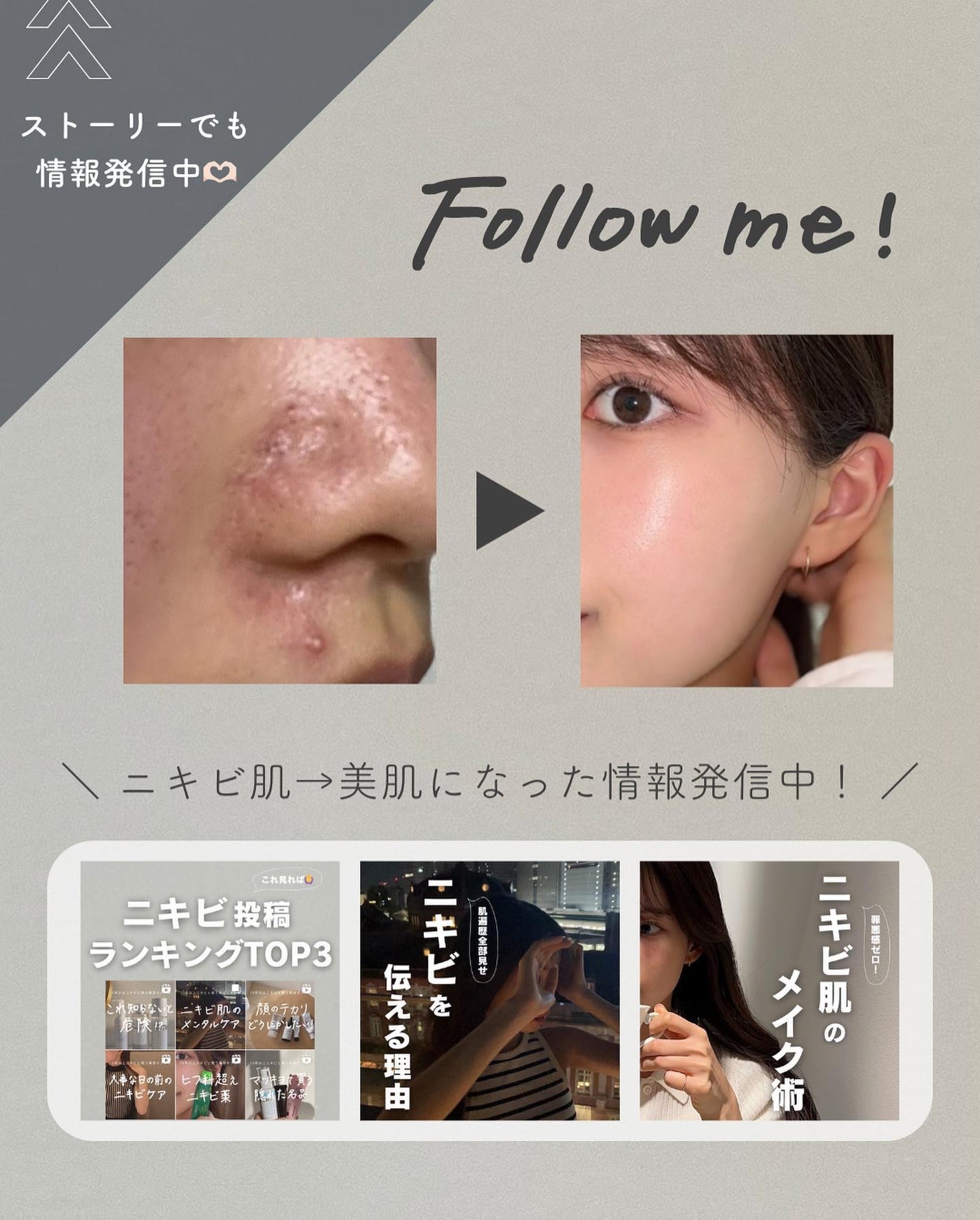 潤浸保湿 乳液/キュレル/乳液を使ったクチコミ(6枚目)