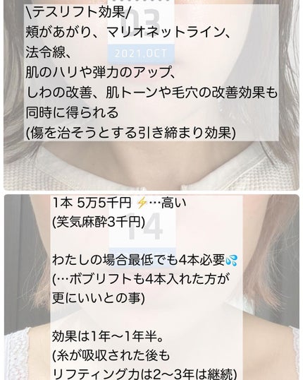 りっちゃん on LIPS 「やって良かった美容医療〜糸リフト編〜/年齢や昨今のマスク😷生..」(5枚目)