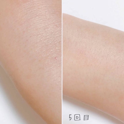 beyda IPL光脱毛器/beyda/家庭用脱毛器を使ったクチコミ(3枚目)