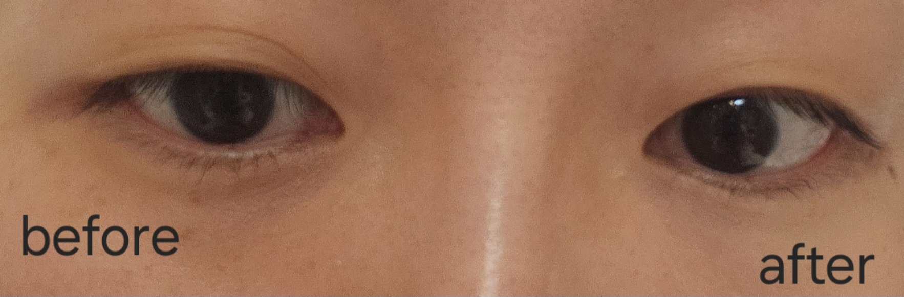 アイレノール クマクリーム/IRENOL/アイケア・アイクリームを使ったクチコミ（3枚目）